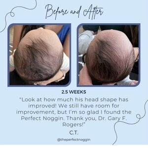 Head noggin Gray and White Baby bed